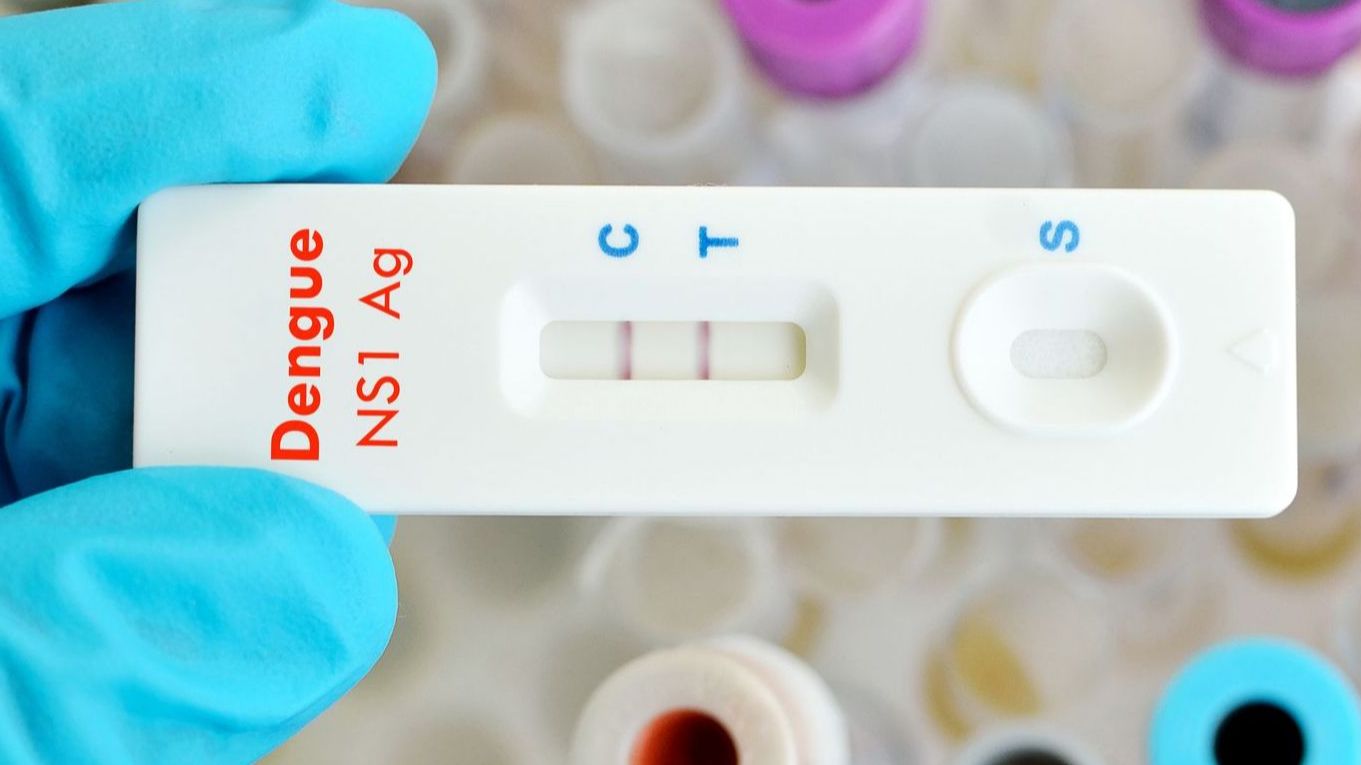​SUS passa a oferecer teste rápido para diagnóstico precoce da dengue