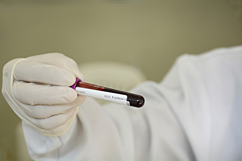 ​Doadores de sangue em Minas já podem acessar resultados de exames pelo celular