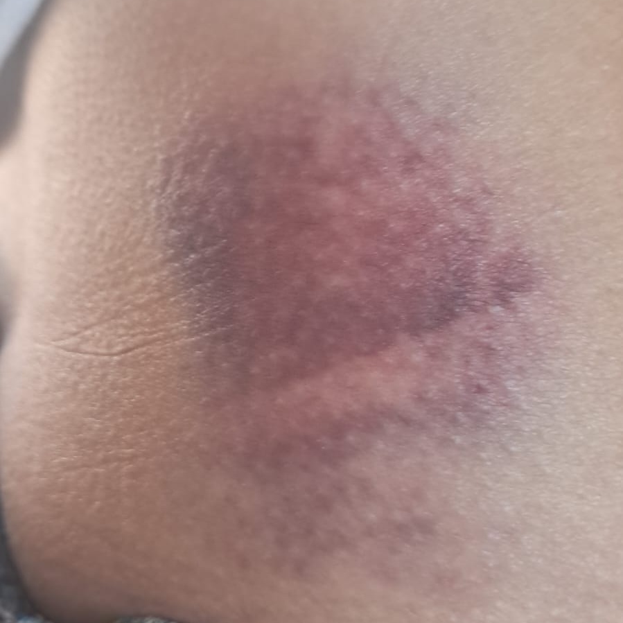 ​Mulher fica ferida após ser agredida pelo irmão em Dores de Campos